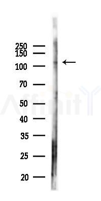 MYO1A Antibody - Western blot analysis of lysates from Hela cells(starvation,24h treatment), using MYO1A Antibody at 1/1000 dilution.