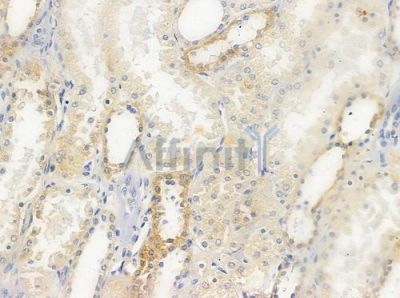 NPHP1 Antibody - DF9678 at 1/100 staining human normal kidney tissue by IHC-P.