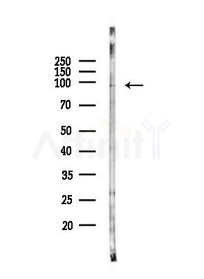 UNC5A Antibody - Western blot analysis of lysates from EC304 cells(heat-shock,45min treatment), using UNC5A Antibody at 1/1000 dilution.