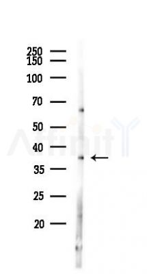 NGRN Antibody - Western blot analysis of lysates from Hela cells(starvation,24h treatment), using NGRN Antibody at 1/1000 dilution.