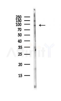NLGN3 Antibody - Western blot analysis of lysates from HepG2 cells(LPS, 4h treatment), using NLGN3 Antibody at 1/1000 dilution.
