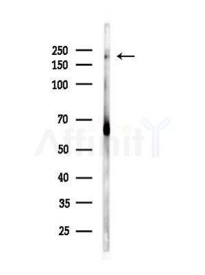 NAV1 Antibody - Western blot analysis of lysates from Mouse brain, using NAV1 Antibody at 1/1000 dilution.