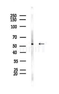 CHRNB4 Antibody - Western blot analysis of lysates from A375 cells, using CHRNB4 Antibody at 1/1000 dilution.