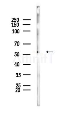 CHRNB4 Antibody - Western blot analysis of lysates from PC12 cells, using CHRNB4 Antibody at 1/1000 dilution.
