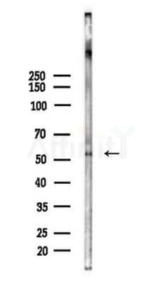 CHRNB4 Antibody - Western blot analysis of lysates from HUVEC cells(heat-shock,45min treatment), using CHRNB4 Antibody at 1/1000 dilution.