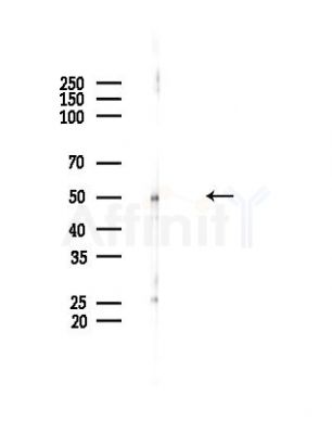 DFNA5/GSDME Antibody - Western blot analysis of lysates from HUVEC cells(LPS,4h treatment), using DFNA5/GSDME Antibody at 1/1000 dilution.