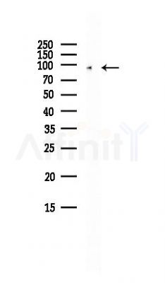 NVL Antibody - Western blot analysis of lysates from HepG2 cells(LPS, 4h treatment), using NVL Antibody at 1/1000 dilution.
