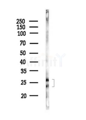 OAZ2 Antibody - Western blot analysis of lysates from HepG2 cells(starvation,24h treatment), using OAZ2 Antibody at 1/1000 dilution.