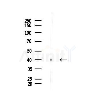 ZDHHC18 Antibody - Western blot analysis of lysates from Mouse lung, using ZDHHC18 Antibody at 1/1000 dilution.