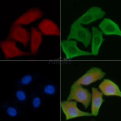 PEX5 Antibody - DF9737 staining Hela cells by IF/ICC.