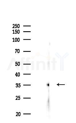 PIGA Antibody - Western blot analysis of lysates from EC304 cells(UV,30min treatment), using PIGA Antibody at 1/1000 dilution.