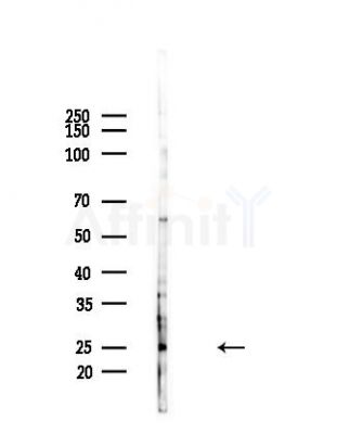 APOBEC3A/B Antibody - Western blot analysis of lysates from Hela cells(heat-shock,45min treatment), using APOBEC3A/B Antibody at 1/1000 dilution.