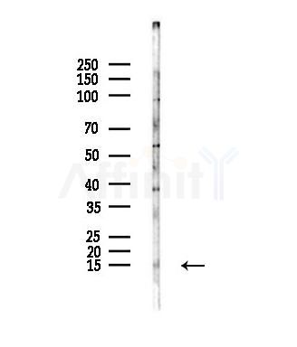 PPP1R14B Antibody - Western blot analysis of lysates from A375 cells(heat-shock,45min treatment), using PPP1R14B Antibody at 1/1000 dilution.