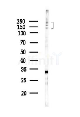 RBM16 Antibody - Western blot analysis of lysates from HepG2 cells(starvation,24h treatment), using RBM16 Antibody at 1/1000 dilution.