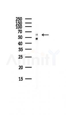 PDP1 Antibody - Western blot analysis of lysates from EC304 cells(LPS, 4h treatment), using PDP1 Antibody at 1/1000 dilution.