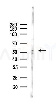 RASGEF1A Antibody - Western blot analysis of lysates from Hela cells(LPS, 4h treatment), using RASGEF1A Antibody at 1/1000 dilution.