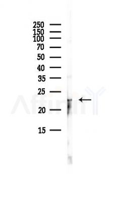 RAB13 Antibody - Western blot analysis of lysates from EC304 cells(LPS, 4h treatment), using RAB13 Antibody at 1/1000 dilution.
