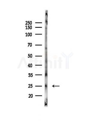 RAB17 Antibody - Western blot analysis of lysates from Mouse liver, using RAB17 Antibody at 1/1000 dilution.