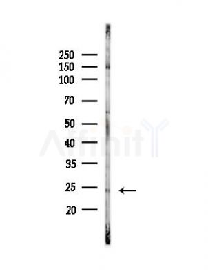 RAB17 Antibody - Western blot analysis of lysates from Hela cells(UV, 30min treatment), using RAB17 Antibody at 1/1000 dilution.