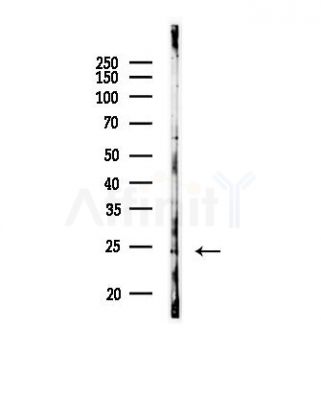 RAB17 Antibody - Western blot analysis of lysates from HepG2 cells(starvation,24h treatment), using RAB17 Antibody at 1/1000 dilution.