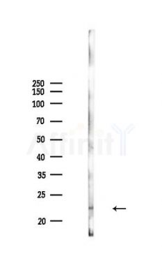 RAB22A Antibody - Western blot analysis of lysates from Mouse lung, using RAB22A Antibody at 1/1000 dilution.