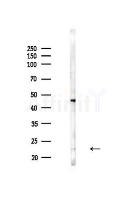 RAB22A Antibody - Western blot analysis of lysates from Hela cells(heat-shock,45min treatment), using RAB22A Antibody at 1/1000 dilution.