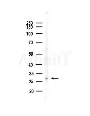 RAB23 Antibody - Western blot analysis of lysates from Mouse liver, using RAB23 Antibody at 1/1000 dilution.