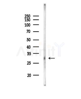 RAB40A Antibody - Western blot analysis of lysates from HepG2 cells(starvation,24h treatment), using RAB40A Antibody at 1/1000 dilution.