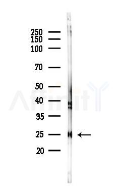 RAB9B Antibody - Western blot analysis of lysates from Rat brain, using RAB9B Antibody at 1/1000 dilution.