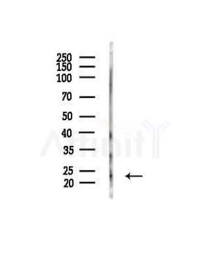 RGS19 Antibody - Western blot analysis of lysates from Mouse liver, using RGS19 Antibody at 1/1000 dilution.