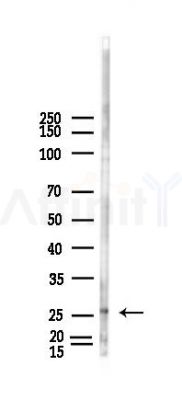 RFPL4B Antibody - Western blot analysis of lysates from HUVEC cells(heat-shock,45min treatment), using RFPL4B Antibody at 1/1000 dilution.