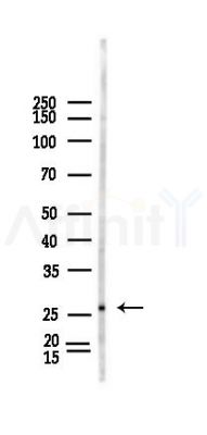 RFPL4B Antibody - Western blot analysis of lysates from Hela cells(LPS,4h treatment), using RFPL4B Antibody at 1/1000 dilution.