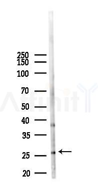 RFPL4B Antibody - Western blot analysis of lysates from B16F10-LUC cells(starvation,24h treatment), using RFPL4B Antibody at 1/1000 dilution.