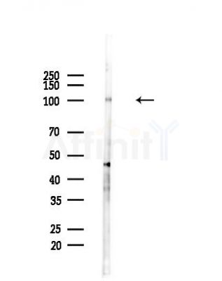RHG12 Antibody - Western blot analysis of lysates from Hela cells(heat-shock,45min treatment), using RHG12 Antibody at 1/1000 dilution.