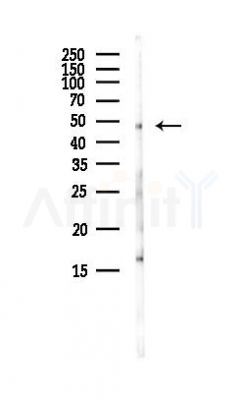 STK25 Antibody - Western blot analysis of lysates from EC304 cells(LPS, 4h treatment), using STK25 Antibody at 1/1000 dilution.
