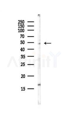 STK25 Antibody - Western blot analysis of lysates from HepG2 cells(LPS, 4h treatment), using STK25 Antibody at 1/1000 dilution.