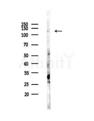 STK31 Antibody - Western blot analysis of lysates from HUVEC cells(LPS,30min treatment), using STK31 Antibody at 1/1000 dilution.