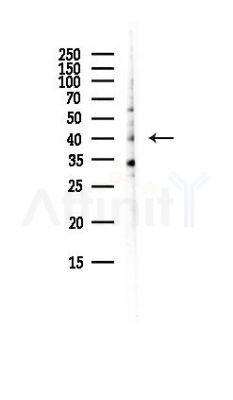 VRK1 Antibody - Western blot analysis of lysates from EC304 cells(LPS, 4h treatment), using VRK1 Antibody at 1/1000 dilution.