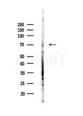 SCML2 Antibody - Western blot analysis of lysates from HepG2 cells(starvation,24h treatment), using SCML2 Antibody at 1/1000 dilution.
