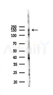 SH3PXD2A Antibody - Western blot analysis of lysates from B16F10-LUC cells(starvation,24h treatment), using SH3PXD2A Antibody at 1/1000 dilution.