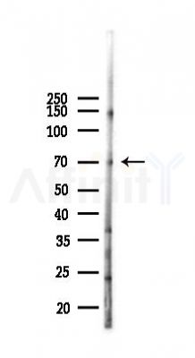 SLC6A14 Antibody - Western blot analysis of lysates from B16F10-LUC cells(starvation,24h treatment), using SLC6A14 Antibody at 1/1000 dilution.