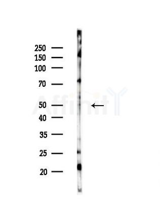 SLC10A4 Antibody - Western blot analysis of lysates from HepG2 cells(starvation,24h treatment), using SLC10A4 Antibody at 1/1000 dilution.