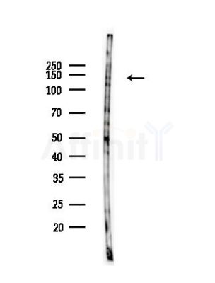 SLC9A10 Antibody - Western blot analysis of lysates from HUVEC cells(LPS,30min treatment), using SLC9A10 Antibody at 1/1000 dilution.