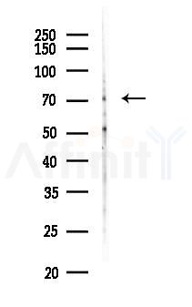 SLC28A1 Antibody - Western blot analysis of lysates from HUVEC cells(heat-shock, 45min treatment), using SLC28A1 Antibody at 1/1000 dilution.