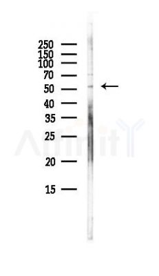 GLUT2 Antibody - Western blot analysis of lysates from EC304 cells(LPS, 4h treatment), using GLUT2 Antibody at 1/1000 dilution.