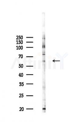 SFRS12 Antibody - Western blot analysis of lysates from COLO205 cells(heat-shock,45min treatment), using SFRS12 Antibody at 1/1000 dilution.