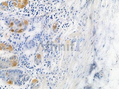 TIGD4 Antibody - DF9960 at 1/100 staining human normal gastric tissue by IHC-P.