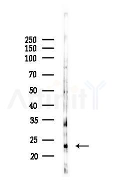 TRAPPC5 Antibody - Western blot analysis of lysates from Mouse testis, using TRAPPC5 Antibody at 1/1000 dilution.
