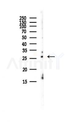 BTF3L3 Antibody - Western blot analysis of lysates from HepG2 cells(LPS, 4h treatment), using BTF3L3 Antibody at 1/1000 dilution.
