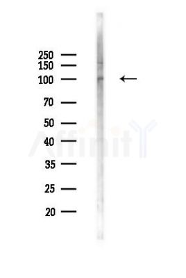 USP29 Antibody - Western blot analysis of lysates from K562 cells(UV,30min treatment), using USP29 Antibody at 1/1000 dilution.